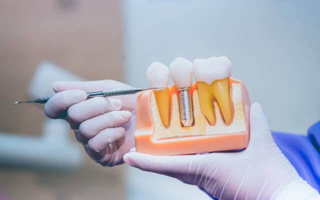 Dentist showing patient a dental implant supported replacement tooth model