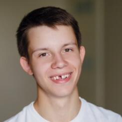 Young person with missing front tooth