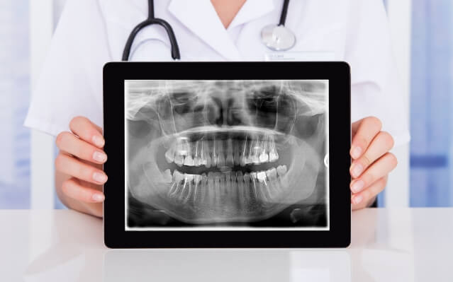 Digital x-rays on tablet computer