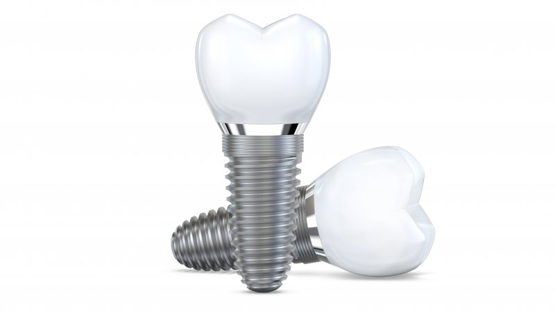 3-D model of a dental implant 