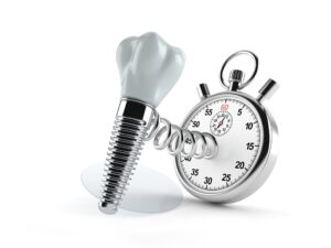 A dental implant springing out of a stop watch