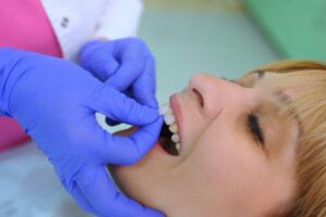 Patient having veneer applied to tooth. 