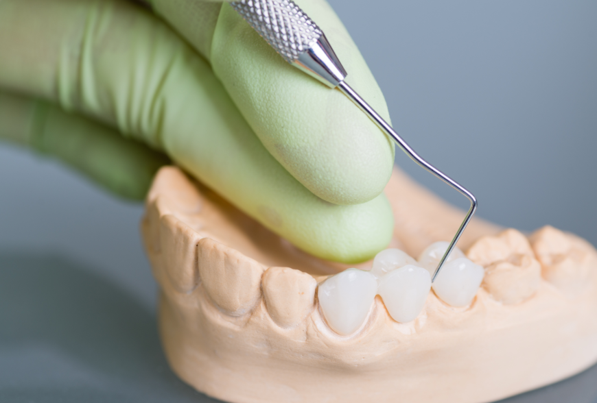 Model dental crown